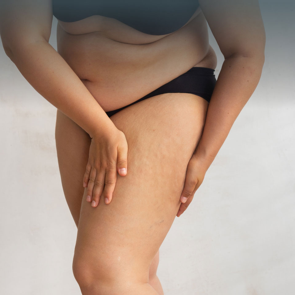 mishawaka thigh light model