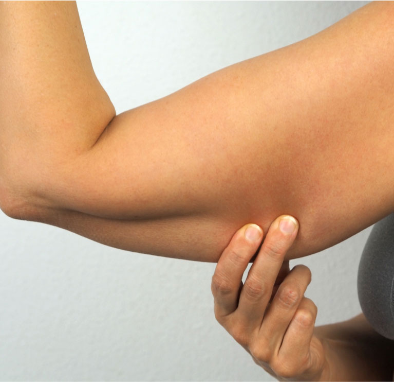 pinching arm fat
